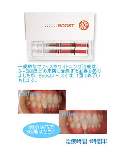Boostコース